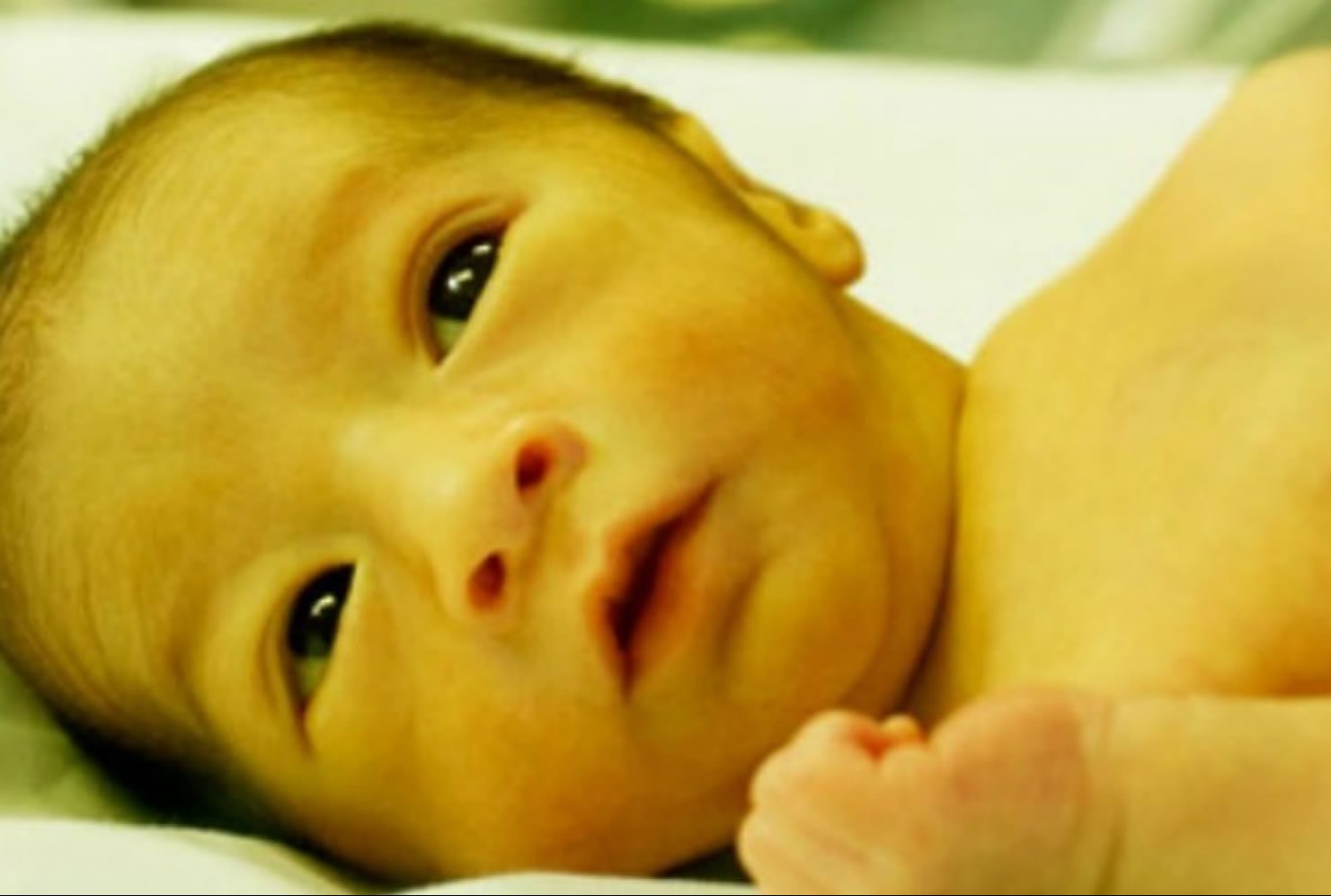 درمان زردی نوزادان با یک نسخه گیاهی